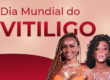 banner dia mundial vitiligo